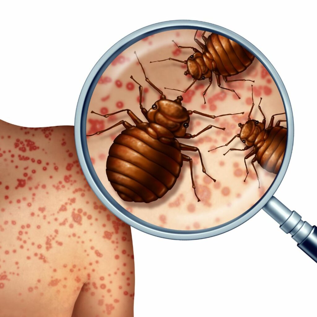 Ten Ways to Prevent Bed Bugs While Travelling